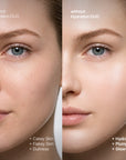 Dewy Slime Mask Set | Deep Hydration (32ml+50ml)