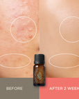 Essenherb Tea Tree 100 Oil (10ml) - AMI Cosmetic
