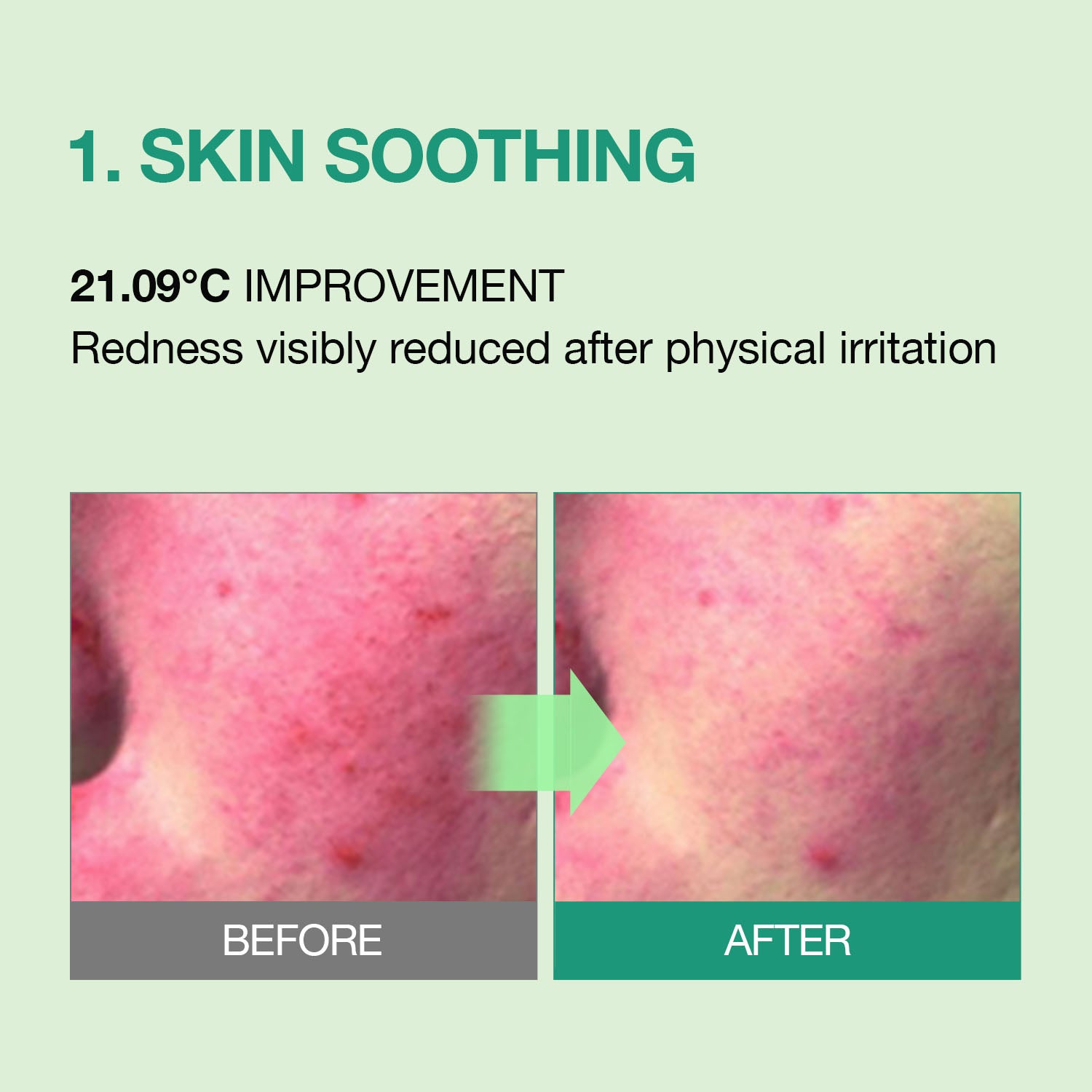 Essenherb Tea Tree Soothing In Calming Cream (80ml) - AMI Cosmetic