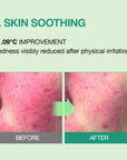 Essenherb Tea Tree Soothing In Calming Cream (80ml) - AMI Cosmetic