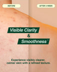 Essenherb Tea Tree 90 Clear Body Mist (200ml) - AMI Cosmetic