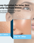 Deep Core Hydra Ampoule - AMI Cosmetic
