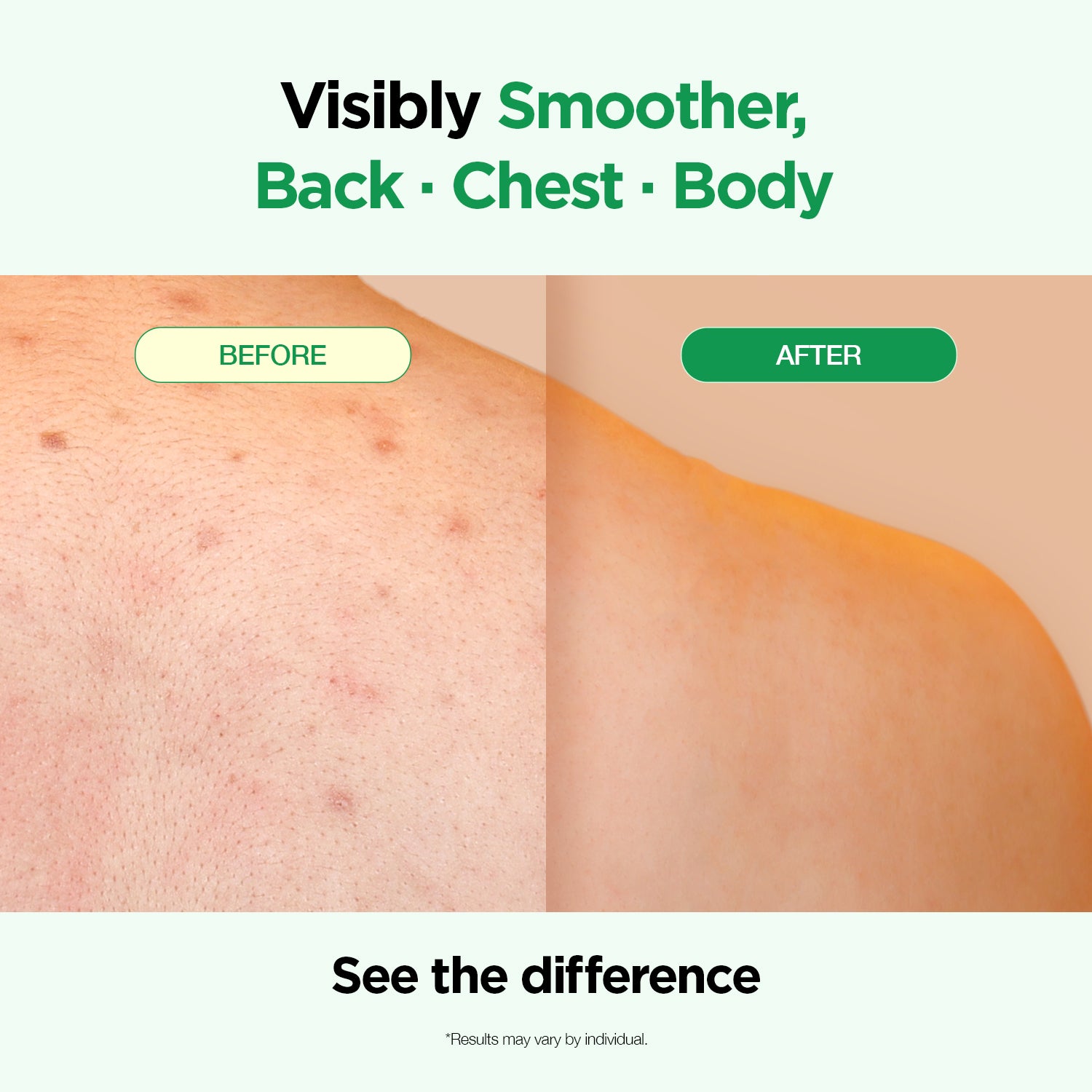 Body Blemish Care Set