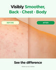 Body Blemish Care Set