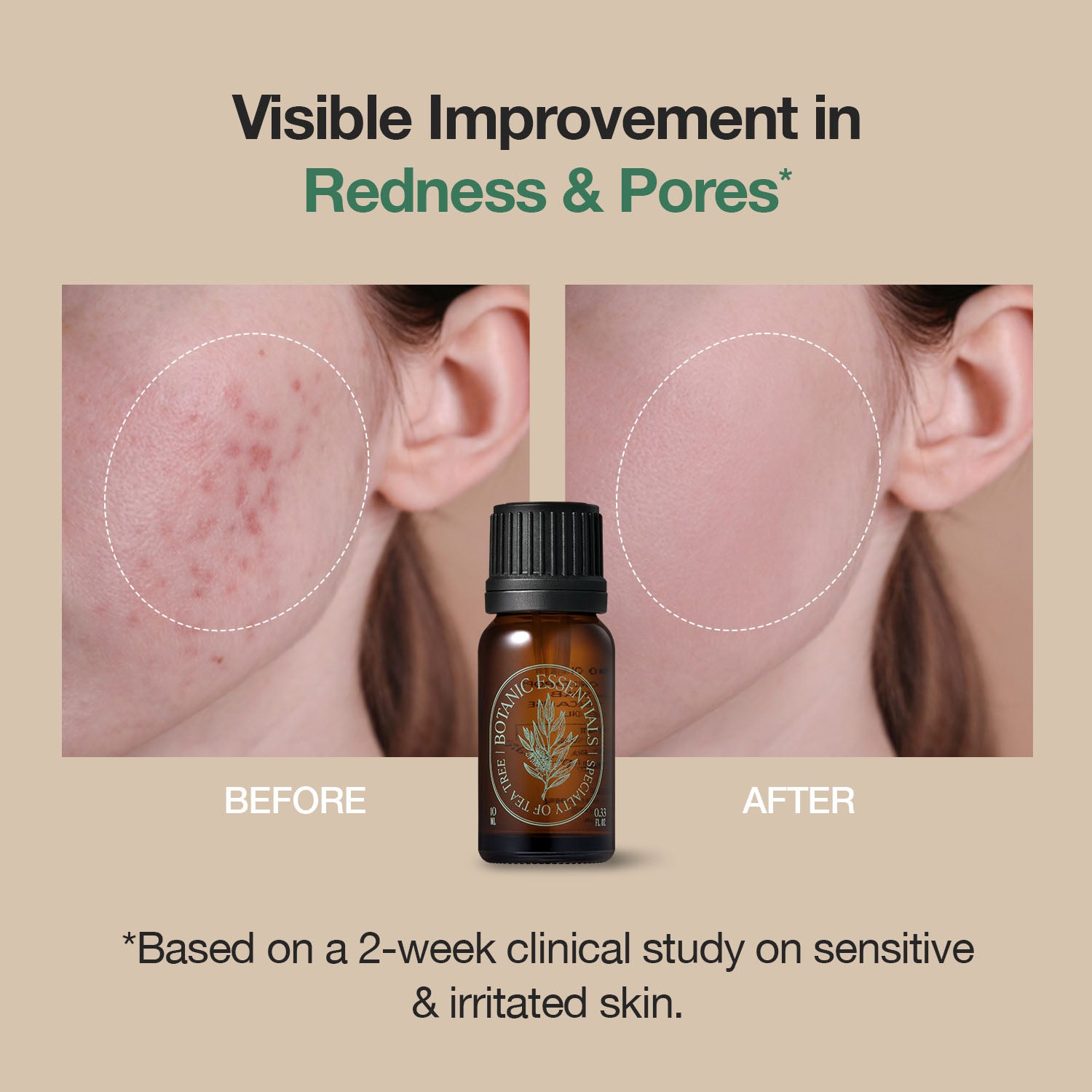 Body Blemish Care Set