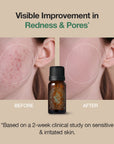 Body Blemish Care Set